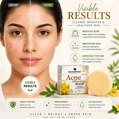 DermaSense Acne & Bleaching Soap For Clear & Bright Skin